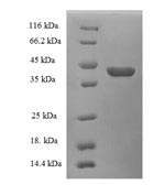 Recombinant Human Cellular retinoic acid-binding protein 1 (CRABP1) – Figure 1 of 1