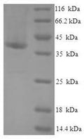 Recombinant Human Death domain-containing protein CRADD (CRADD) – Figure 1 of 1