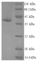 Recombinant Human Death domain-containing protein CRADD (CRADD) – Figure 1 of 1