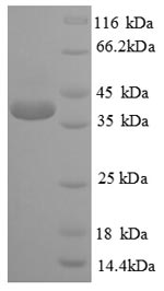 Recombinant Human Cyclic AMP-responsive element-binding protein 1 (CREB1) – Figure 1 of 1