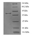 Recombinant Human Corticotropin-releasing factor receptor 1 (CRHR1), partial – Figure 1 of 1