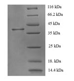 Recombinant Human Corticotropin-releasing factor receptor 1 (CRHR1), partial – Figure 1 of 1