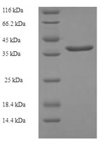 Recombinant Human Cysteine-rich protein 2 (CRIP2) – Figure 1 of 1