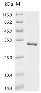 (Tris-Glycine gel) Discontinuous SDS-PAGE (reduced) with 5% enrichment gel and 15% separation gel.