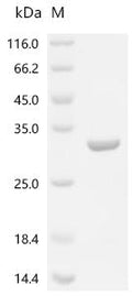 (Tris-Glycine gel) Discontinuous SDS-PAGE (reduced) with 5% enrichment gel and 15% separation gel.