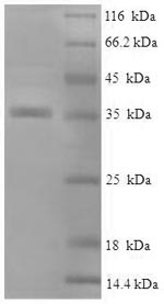 Recombinant Human Alpha-crystallin B chain (CRYAB) – Figure 1 of 1