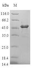 (Tris-Glycine gel) Discontinuous SDS-PAGE (reduced) with 5% enrichment gel and 15% separation gel.