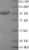 Recombinant Human Citrate synthase, mitochondrial (CS), partial – Figure 1 of 1