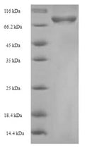 Recombinant Mouse Cysteine sulfinic acid decarboxylase (Csad) – Figure 1 of 1
