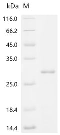 (Tris-Glycine gel) Discontinuous SDS-PAGE (reduced) with 5% enrichment gel and 15% separation gel.