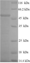 Recombinant Human Granulocyte-macrophage colony-stimulating factor receptor subunit alpha (CSF2RA), partial – Figure 1 of 1