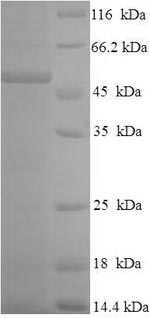 Recombinant Human Granulocyte-macrophage colony-stimulating factor receptor subunit alpha (CSF2RA), partial – Figure 1 of 1