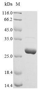 (Tris-Glycine gel) Discontinuous SDS-PAGE (reduced) with 5% enrichment gel and 15% separation gel.