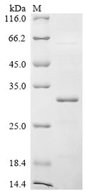 (Tris-Glycine gel) Discontinuous SDS-PAGE (reduced) with 5% enrichment gel and 15% separation gel.