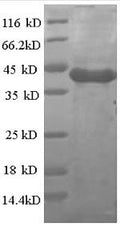 Recombinant Human Casein kinase I isoform alpha (CSNK1A1) – Figure 1 of 1