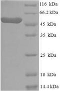 Recombinant Human Casein kinase I isoform epsilon (CSNK1E) – Figure 1 of 1