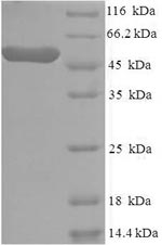 Recombinant Human Casein kinase I isoform epsilon (CSNK1E) – Figure 1 of 1