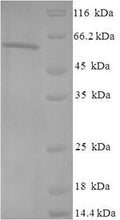 Recombinant Human Casein kinase II subunit alpha (CSNK2A1) – Figure 1 of 1