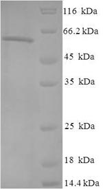 Recombinant Human Casein kinase II subunit alpha (CSNK2A1) – Figure 1 of 1