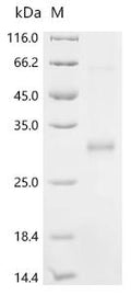 (Tris-Glycine gel) Discontinuous SDS-PAGE (reduced) with 5% enrichment gel and 15% separation gel.