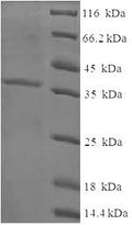 Recombinant Human Cysteine and glycine-rich protein 3 (CSRP3) – Figure 1 of 1