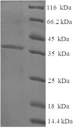 Recombinant Human Cysteine and glycine-rich protein 3 (CSRP3) – Figure 1 of 1