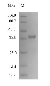 Recombinant Human Cancer/testis antigen 2 (CTAG2) – Figure 1 of 1