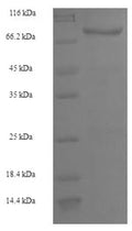Recombinant Mouse Transcriptional repressor CTCFL (Ctcfl) – Figure 1 of 1