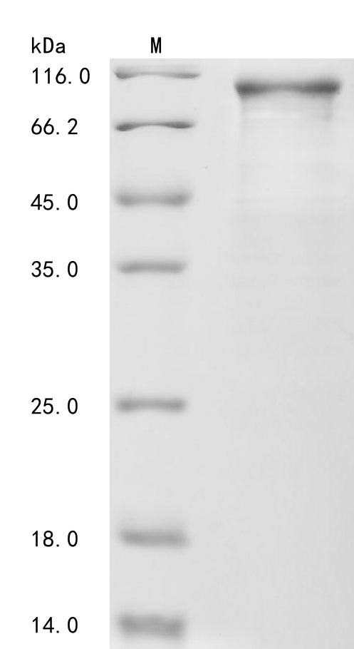 (Tris-Glycine gel) Discontinuous SDS-PAGE (reduced) with 5% enrichment gel and 15% separation gel.