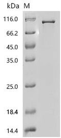 Recombinant Human Catenin beta-1 (CTNNB1) – Figure 1 of 1