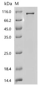 Recombinant Human Catenin beta-1 (CTNNB1) – Figure 1 of 1
