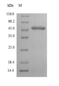 (Tris-Glycine gel) Discontinuous SDS-PAGE (reduced) with 5% enrichment gel and 15% separation gel.