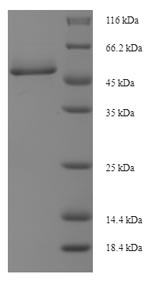 Recombinant Cricetulus griseus Cathepsin D (Ctsd), partial – Figure 1 of 1