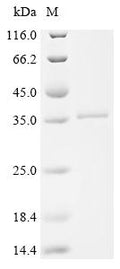 (Tris-Glycine gel) Discontinuous SDS-PAGE (reduced) with 5% enrichment gel and 15% separation gel.