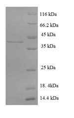Recombinant Mouse Cathepsin G (Ctsg) – Figure 1 of 1