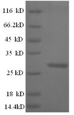 Recombinant Mouse Cathepsin K (Ctsk) – Figure 1 of 1