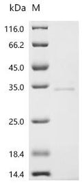 Recombinant Macaca fascicularis Cathepsin K (CTSK) – Figure 1 of 1