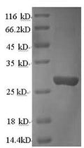 Recombinant Rat Cathepsin K (Ctsk) – Figure 1 of 1