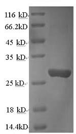 Recombinant Rat Cathepsin K (Ctsk) – Figure 1 of 1