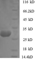 Recombinant Rabbit Cathepsin K (Ctsk) – Figure 1 of 1