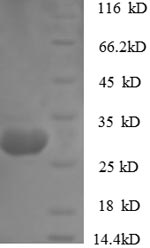 Recombinant Rabbit Cathepsin K (Ctsk) – Figure 1 of 1