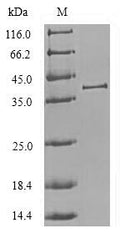 Recombinant Chlorocebus aethiops Cathepsin L1 (CTSL1), partial – Figure 1 of 1