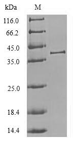Recombinant Chlorocebus aethiops Cathepsin L1 (CTSL1), partial – Figure 1 of 1