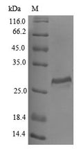 (Tris-Glycine gel) Discontinuous SDS-PAGE (reduced) with 5% enrichment gel and 15% separation gel.
