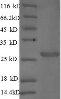 Recombinant Mouse Cathepsin S (Ctss) – Figure 1 of 1