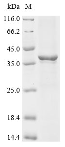 (Tris-Glycine gel) Discontinuous SDS-PAGE (reduced) with 5% enrichment gel and 15% separation gel.