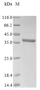 (Tris-Glycine gel) Discontinuous SDS-PAGE (reduced) with 5% enrichment gel and 15% separation gel.
