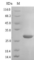 (Tris-Glycine gel) Discontinuous SDS-PAGE (reduced) with 5% enrichment gel and 15% separation gel.