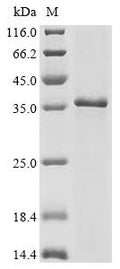 (Tris-Glycine gel) Discontinuous SDS-PAGE (reduced) with 5% enrichment gel and 15% separation gel.