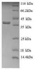 Recombinant Human Cytochrome c (CYCS) – Figure 1 of 1